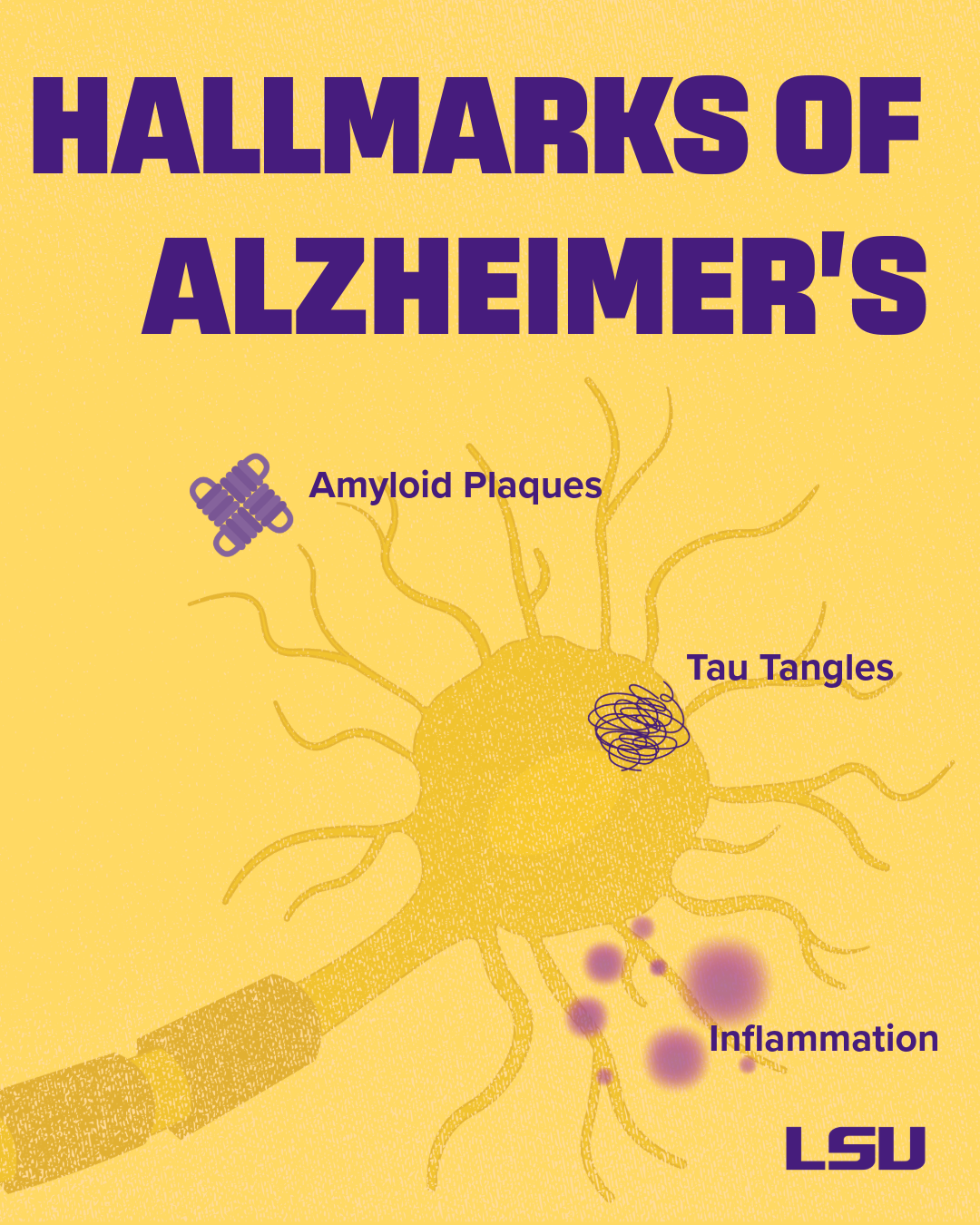 Human neurons in culture showing cell bodies and axon in pinkish color and glia in the background in green